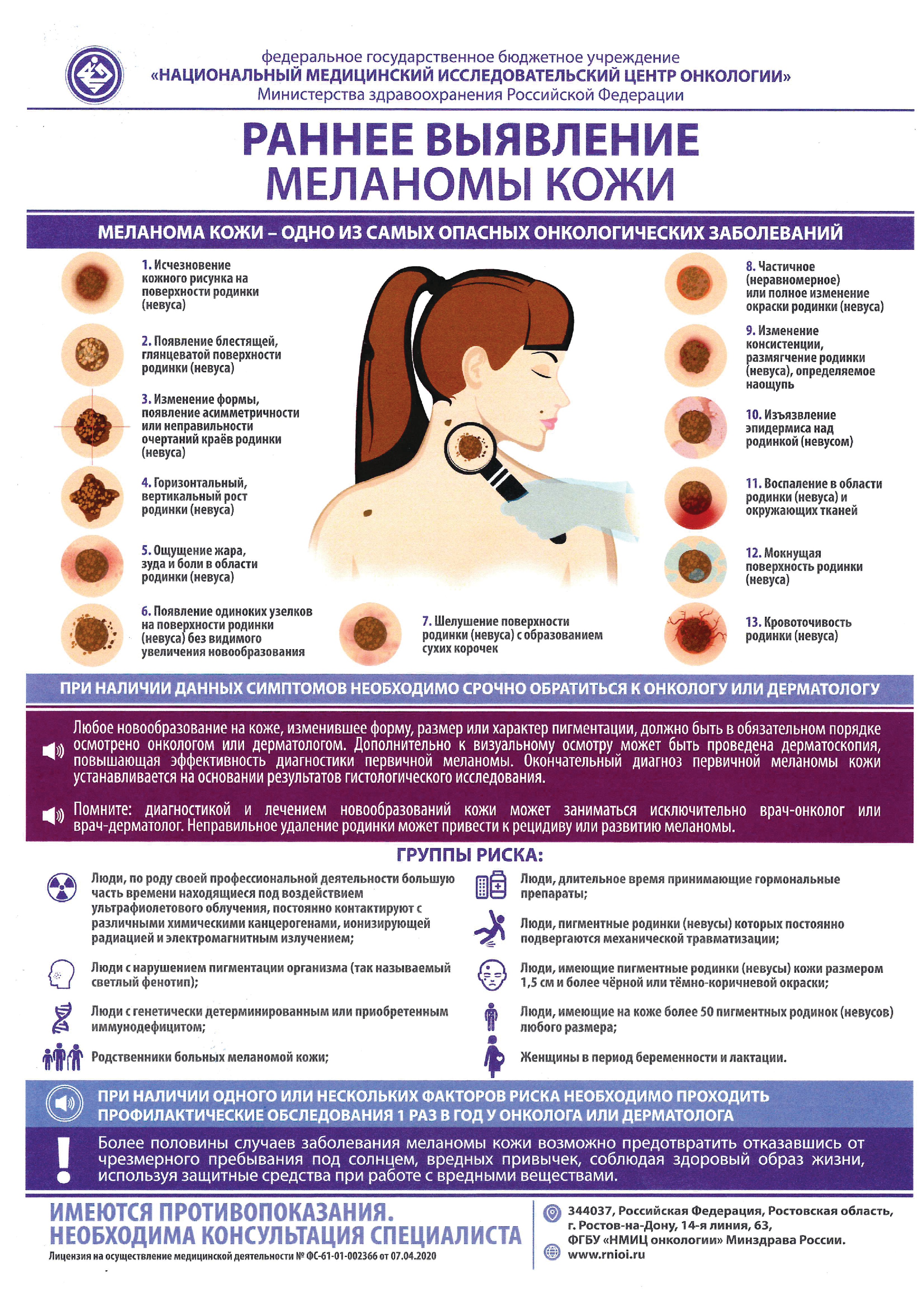 1-melanoma_kozhi.jpg